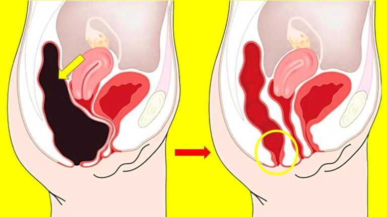 How to Cleanse Your Colon At Home Naturally, Colon Cleanse Smoothie Recipes